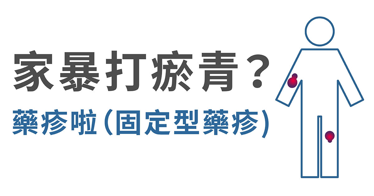 固定型藥疹,固定性藥疹,藥物過敏,藥物疹,