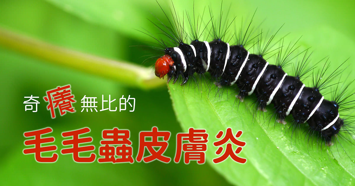 æ¯æ¯è²ç®èçï¼caterpillar dermatitis