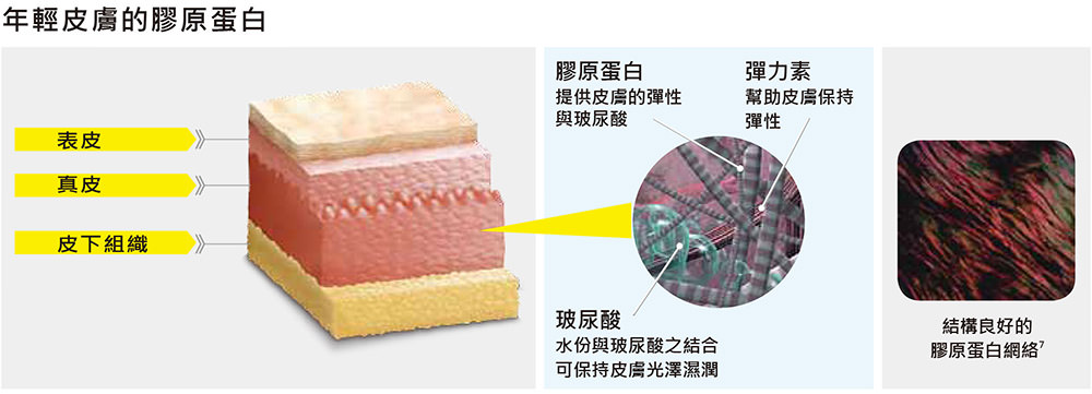 ellanse, 伊蓮絲, 伊戀詩