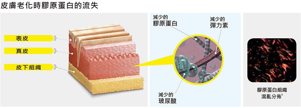 ellanse, 伊蓮絲, 伊戀詩