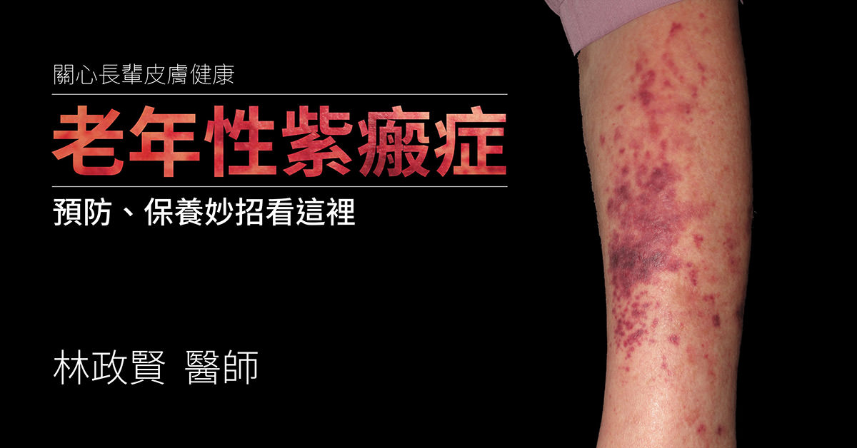 senile purpura,老年性紫瘢症,紫斑症,actinic purpura