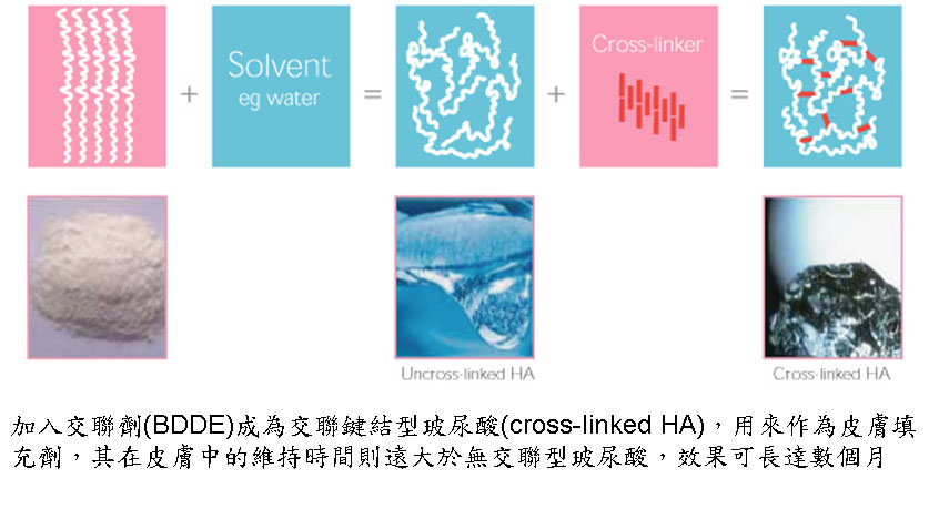 juvederm,喬雅登,玻尿酸,微整形,微整型