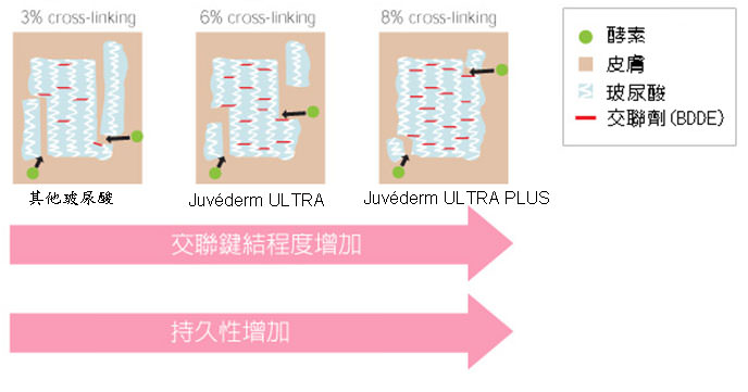 juvederm,喬雅登,玻尿酸,微整形,微整型