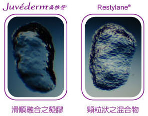 喬雅登,juvederm,玻尿酸注射,微整形