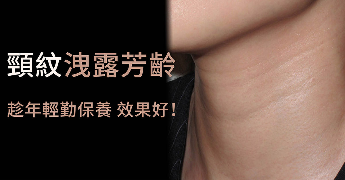 頸紋,玻尿酸,微整形注射,喬雅登,juvederm,瑞絲朗,restylane,雞脖子,舒顏萃,sulpctra,3D聚左旋乳酸,微晶瓷,