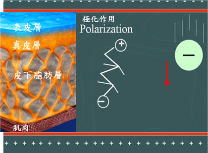 高雄電波拉皮,熱世紀,thermage,無痛電波拉皮,CPT,第三代電波拉皮