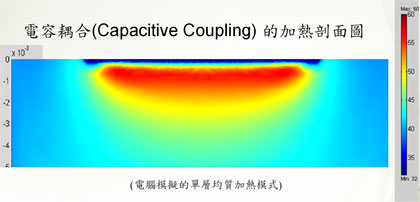 高雄電波拉皮,電波拉皮價格,電波拉皮費用,熱世紀,第三代,無痛電波拉皮,CPT,thermage