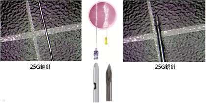 高雄微整形,微型鈍針,microcannula,平價微整形,瑞絲朗,喬雅登