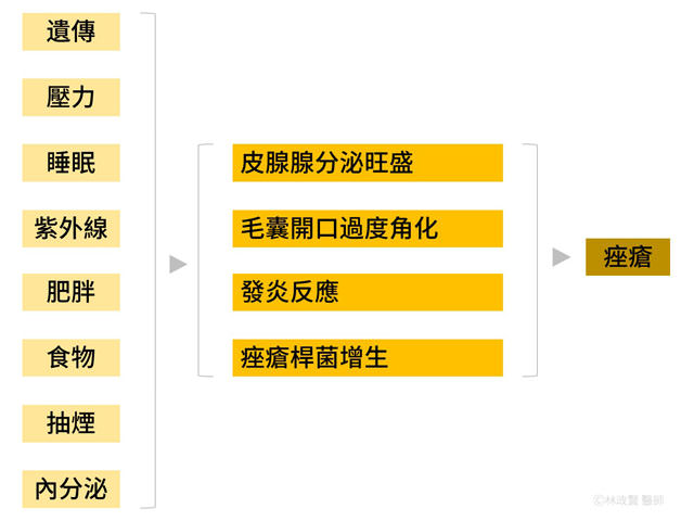 青春痘,粉刺,病因,痤瘡,acne