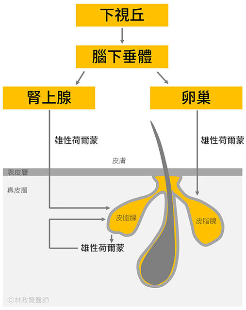 青春痘,痘痘,痤瘡,壓力痘,荷爾蒙痘,內分泌失調