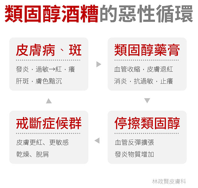 臉潮紅,臉紅,微血管擴張,血管絲,酒糟,酒渣,類固醇,玫瑰斑,rosacea,steroid dermatitis,soolantra,elidel,mirvaso,舒利達,舒立達,敏立紓,敏立舒