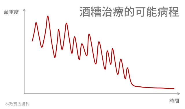 臉潮紅,臉紅,微血管擴張,血管絲,酒糟,酒渣,類固醇,玫瑰斑,rosacea,steroid dermatitis,soolantra,elidel,mirvaso,舒利達,舒立達,敏立紓,敏立舒