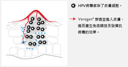 veregen,酚瑞淨,菜花,尖頭濕疣,尖圭濕疣