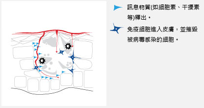 veregen,酚瑞淨,菜花,尖頭濕疣,尖圭濕疣