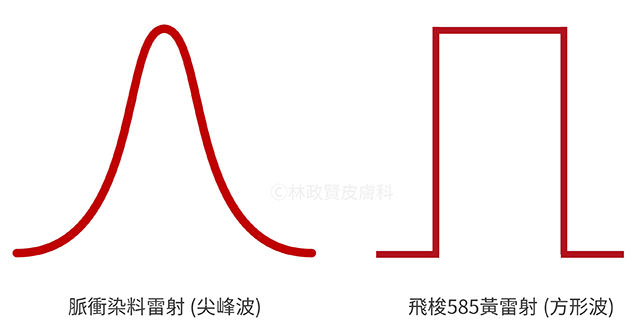 飛梭,585,黃雷射