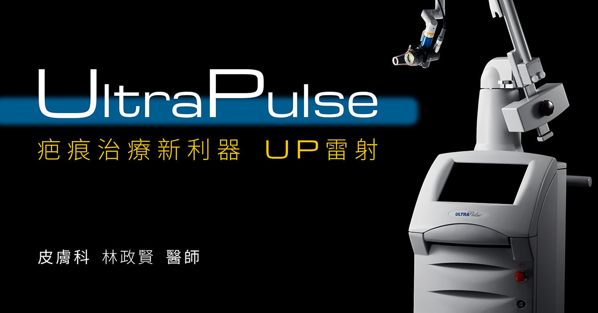 ultrapulse,up雷射,痘疤,疤痕,外傷疤痕,燒燙傷疤痕高雄UP雷射推薦