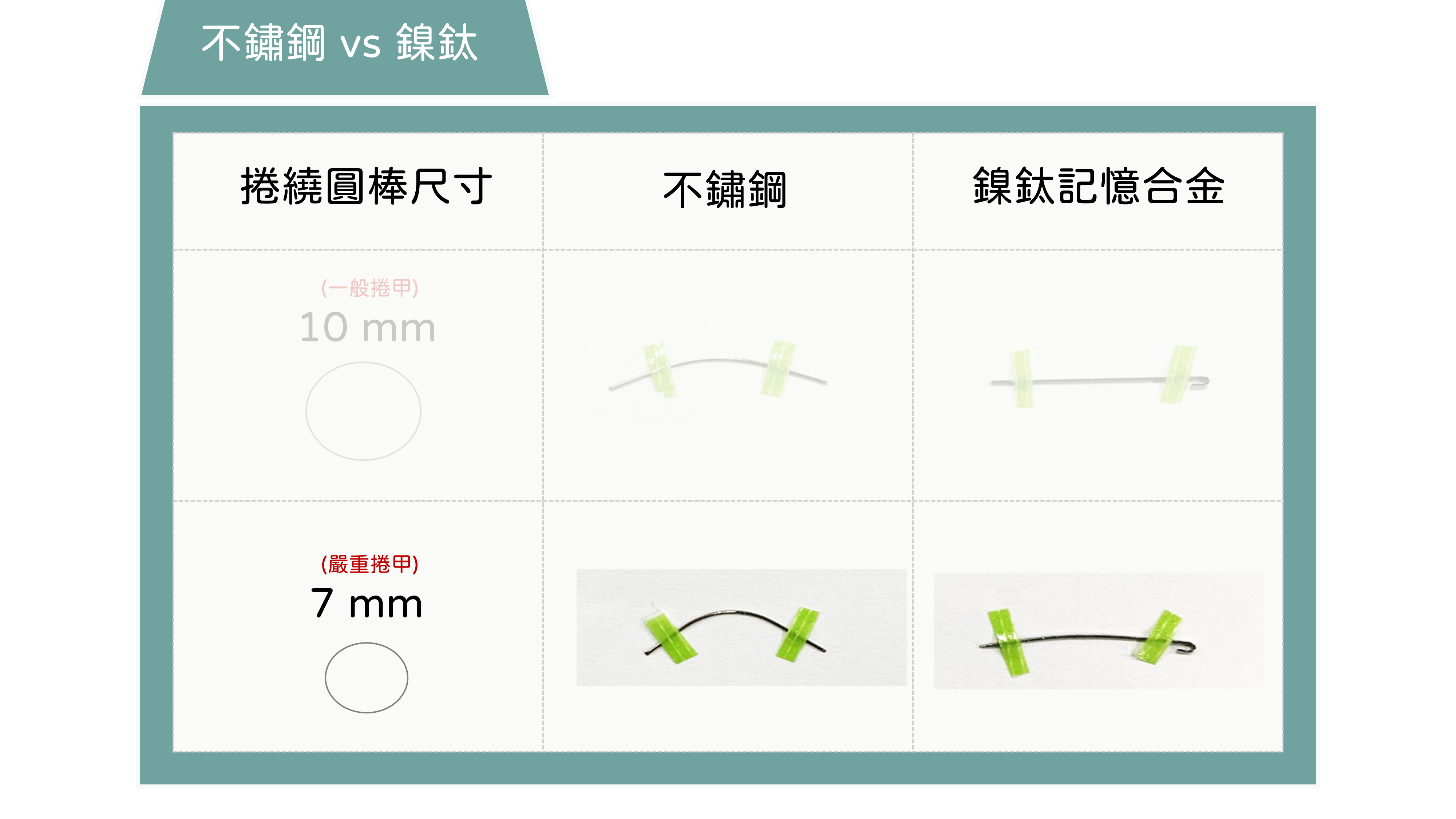 指甲矯正,問題指甲,咬指甲,矯正指甲,凝膠指甲,水晶指甲,甲床剝離,甲肉萎縮,甲床分離,硬繭,扇形指甲,嵌甲矯正器,鎳鈦合金,記憶金屬,不鏽鋼指甲矯正器,Spange,Podofix,Naspan,維持器,甲溝炎,凍甲,盪甲,當甲,指甲 化膿,剪指甲,Combiped,指甲脆弱,指甲矯正器,趾甲矯正器,3to,podofix,nail,brace,拔指甲,拔趾甲,spange,combiped,嵌甲,香港腳,足癬,黴菌感染,灰指甲,蜂窩性組織炎,汗皰疹,灰趾甲,灰指甲治療,灰指甲偏方,灰指甲預防,灰指甲顏色,onychomycosis,tinea unguium,變色指甲,athletes foot on hands,灰指甲藥膏,樂指力,嵌甲症,口服抗黴菌,外用抗黴菌,UP雷射,甲癬,手癬,股癬,胯下癢,3 to,甲床分離 治療,指甲脆弱 原因,里特指甲矯正器,里特,里特嵌甲矯正器,里特崁甲矯正器,鎳鈦指甲矯正器,nit,指甲倒插,指甲倒刺,肉芽,鎳鈦嵌甲矯正器,鎳鈦崁甲矯正器,nit spange brace