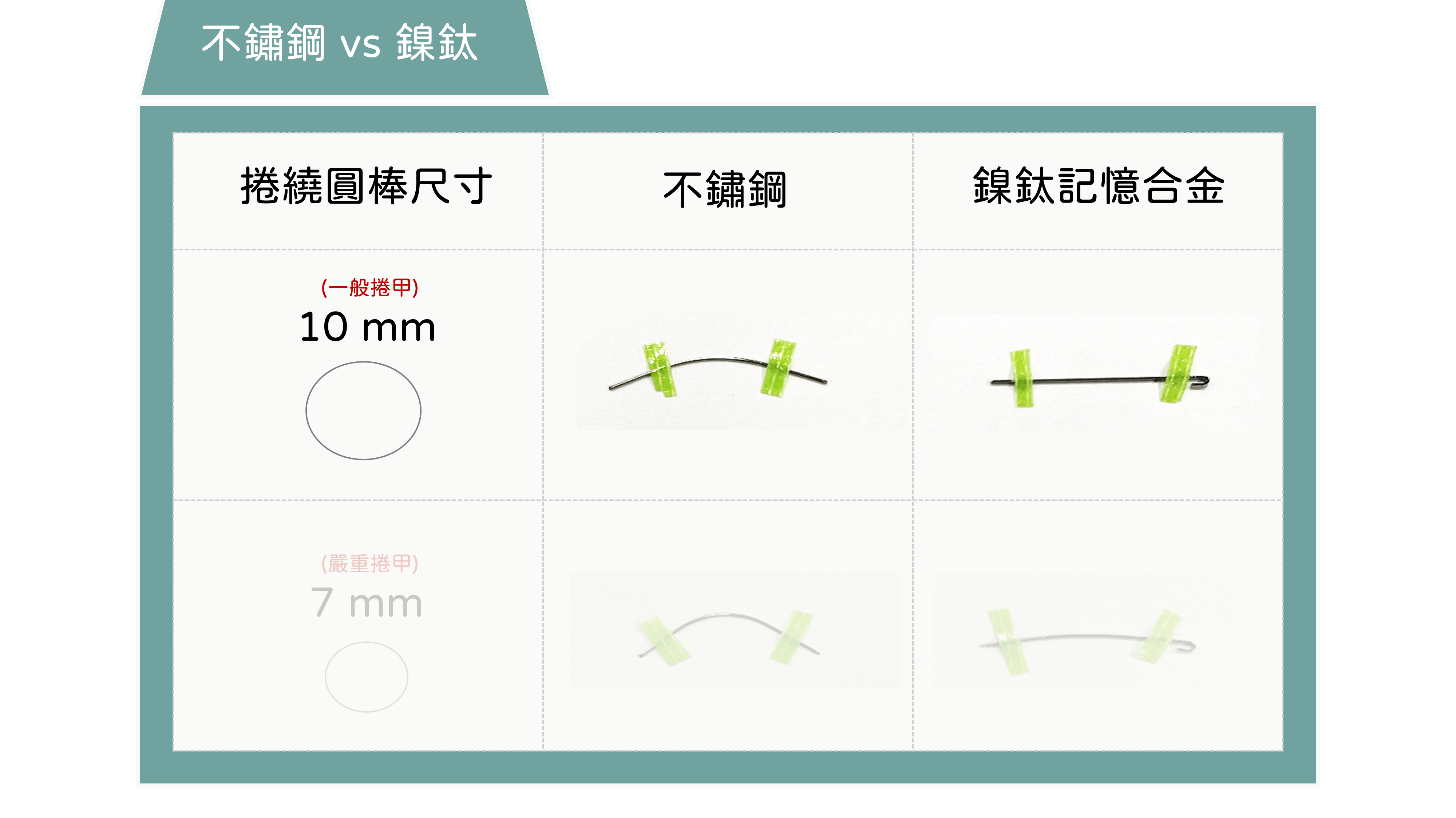 指甲矯正,問題指甲,咬指甲,矯正指甲,凝膠指甲,水晶指甲,甲床剝離,甲肉萎縮,甲床分離,硬繭,扇形指甲,嵌甲矯正器,鎳鈦合金,記憶金屬,不鏽鋼指甲矯正器,Spange,Podofix,Naspan,維持器,甲溝炎,凍甲,盪甲,當甲,指甲 化膿,剪指甲,Combiped,指甲脆弱,指甲矯正器,趾甲矯正器,3to,podofix,nail,brace,拔指甲,拔趾甲,spange,combiped,嵌甲,香港腳,足癬,黴菌感染,灰指甲,蜂窩性組織炎,汗皰疹,灰趾甲,灰指甲治療,灰指甲偏方,灰指甲預防,灰指甲顏色,onychomycosis,tinea unguium,變色指甲,athletes foot on hands,灰指甲藥膏,樂指力,嵌甲症,口服抗黴菌,外用抗黴菌,UP雷射,甲癬,手癬,股癬,胯下癢,3 to,甲床分離 治療,指甲脆弱 原因,里特指甲矯正器,里特,里特嵌甲矯正器,里特崁甲矯正器,鎳鈦指甲矯正器,nit,指甲倒插,指甲倒刺,肉芽,鎳鈦嵌甲矯正器,鎳鈦崁甲矯正器,nit spange brace