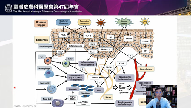 林政賢皮膚科,林政賢醫師,酒糟肌如何選防曬乳液,高雄酒糟專家