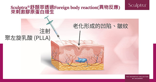 舒顏萃,sculptra,3D聚左旋乳酸,PLLA,把青春一點一滴找回來,減齡三部曲