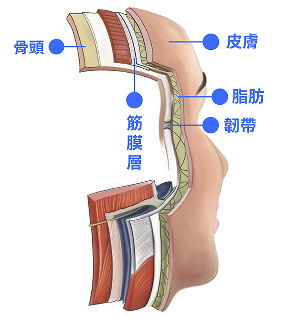 嘴邊肉,木偶紋,嬰兒肥,臉大,電波,音波,拉提嘴邊肉