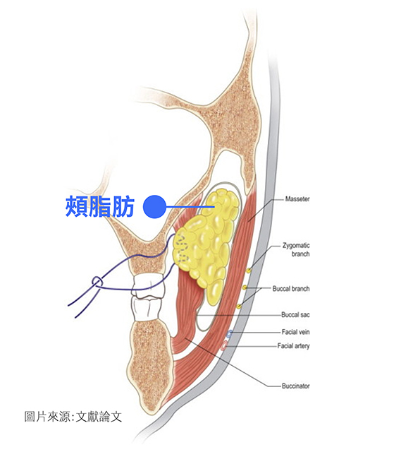 嘴邊肉,木偶紋,嬰兒肥,臉大,電波,音波,拉提嘴邊肉,真童妍,玻尿酸拉提,晶亮瓷,埋線拉提