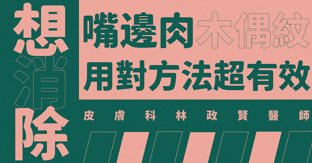 嘴邊肉,木偶紋,嬰兒肥,臉大,電波,音波,拉提嘴邊肉,真童妍,玻尿酸拉提,晶亮瓷,埋線拉提,真童妍,玻尿酸,晶亮瓷,手術拉提