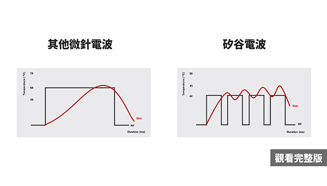 黑斑,肝斑,黑斑 治療,思膚安,矽谷電波,sylfirm,斑點,雀斑,太田母斑,顴骨母斑,曬斑,老人斑,保養品,藥物,雷射,治療斑點,外用A酸,黑色素,除斑,防曬,老化,光老化,色素沉澱,除斑雷射,雷射除斑,去除斑,消除斑點,肥胖紋,生長紋,妊娠紋,妊娠紋 治療,希思珮樂,探索皮秒,皮秒雷射,黃褐斑,荷爾蒙斑,孕斑,三合一美白藥膏,淨膚雷射,cyspera,希思佩樂,美白藥膏,傳明酸,淡化斑點,檸檬,雷射術後反黑,希斯珮樂,西斯佩樂,西思佩樂,西思珮樂,臉色黯沉,極速袪斑,去色斑,基底膜破損,微血管增生,染料雷射,585黃雷射,cyspera dark skin,sylfirm treatment,黑斑 治療方法,色素沉澱 怎麼辦,sylfirm x treatment,白斑治疗,sylfirm before and after,cysteamine,美白淡斑,膚色暗沉,皮膚暗沉,皮膚黯沉,膚色黯沉,膚色不均,淨膚雷射