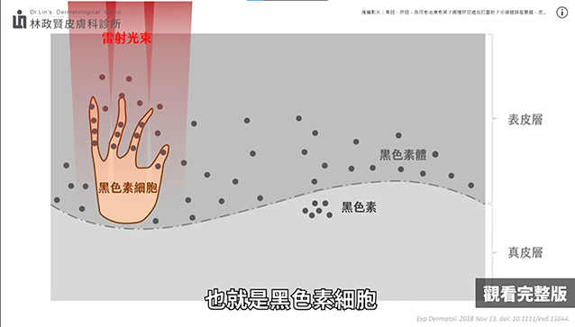 黑斑,肝斑,黑斑 治療,思膚安,矽谷電波,sylfirm,斑點,雀斑,太田母斑,顴骨母斑,曬斑,老人斑,保養品,藥物,雷射,治療斑點,外用A酸,黑色素,除斑,防曬,老化,光老化,色素沉澱,除斑雷射,雷射除斑,去除斑,消除斑點,肥胖紋,生長紋,妊娠紋,妊娠紋 治療,希思珮樂,探索皮秒,皮秒雷射,黃褐斑,荷爾蒙斑,孕斑,三合一美白藥膏,淨膚雷射,cyspera,希思佩樂,美白藥膏,傳明酸,淡化斑點,檸檬,雷射術後反黑,希斯珮樂,西斯佩樂,西思佩樂,西思珮樂,臉色黯沉,極速袪斑,去色斑,基底膜破損,微血管增生,染料雷射,585黃雷射,cyspera dark skin,sylfirm treatment,黑斑 治療方法,色素沉澱 怎麼辦,sylfirm x treatment,白斑治疗,sylfirm before and after,cysteamine,美白淡斑,膚色暗沉,皮膚暗沉,皮膚黯沉,膚色黯沉,膚色不均,淨膚雷射