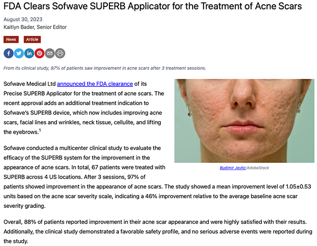 sofwave,索夫波,痘疤,凹痘疤,acne scar,FDA