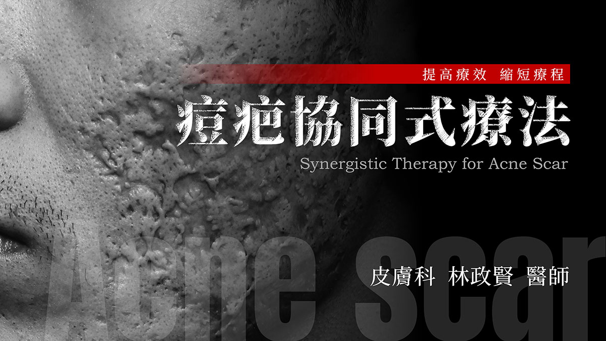 痘疤的協同式療法，synergistic therapy for acne scar，協同式的痘疤療法