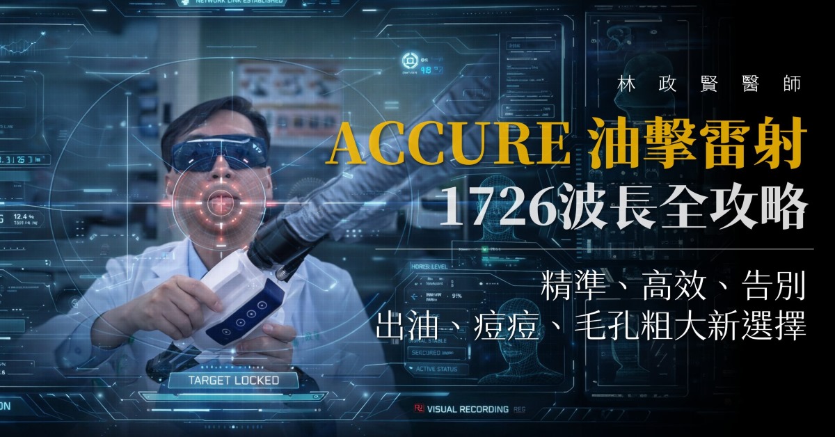 Accure,油擊雷射,痘痘,皮脂腺,油痘肌,油性肌膚,控油,外用A酸,抗痘