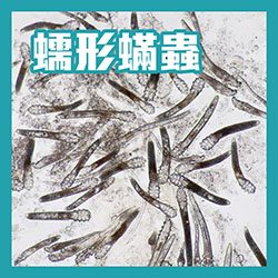 酒糟,蠕形蟎蟲,蠕型蟎蟲,demodex,demodicosis,舒利達,舒立達,soolantra,酒渣,玫瑰斑