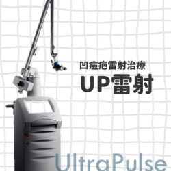 UP雷射,UltraPulse,痘疤治療